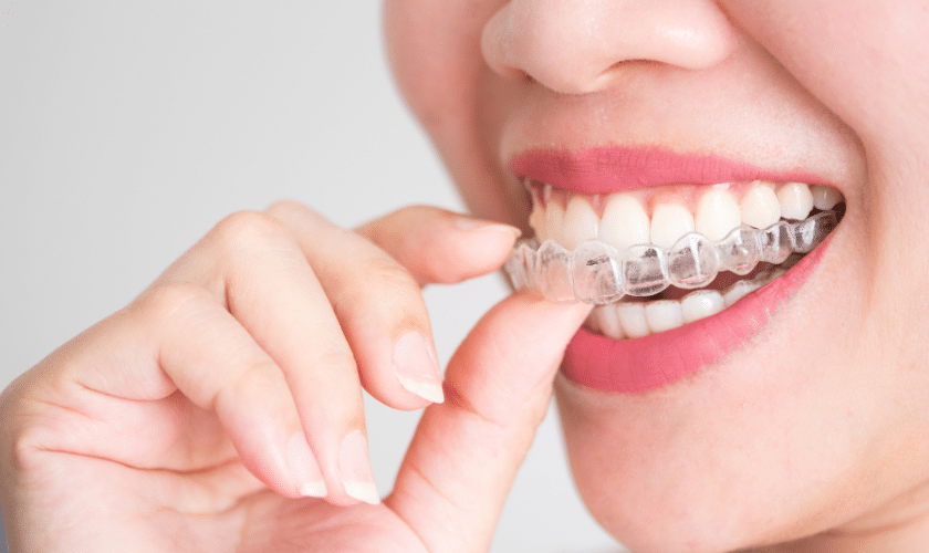 Featured image for “Invisalign Myths Debunked: Separating Fact from Fiction”