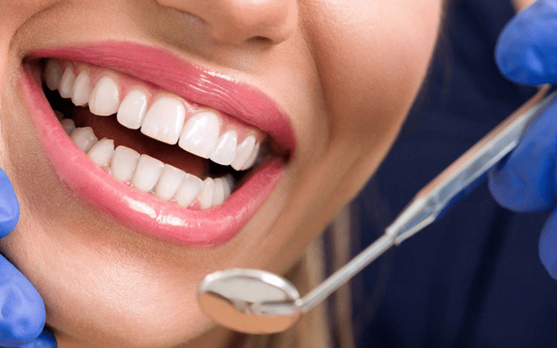 Featured image for “Can Dental Bonding Be Repaired? Tips To Maintain Your Bonded Teeth”